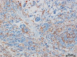 Junrong Zou