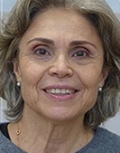 Asunción Fernández