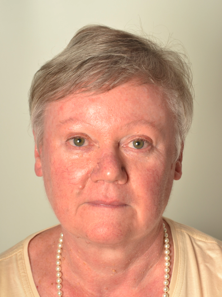 Linda Thienpont
