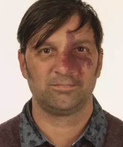 Craig Storey