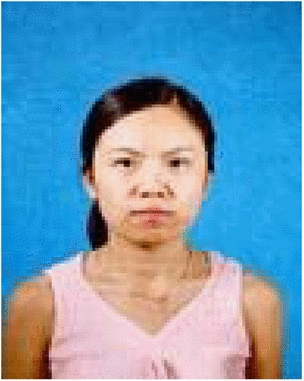 Hui Zheng