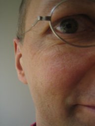 Frank Nack