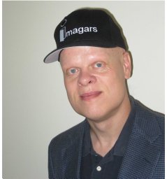 Baldur Steingrimsson
