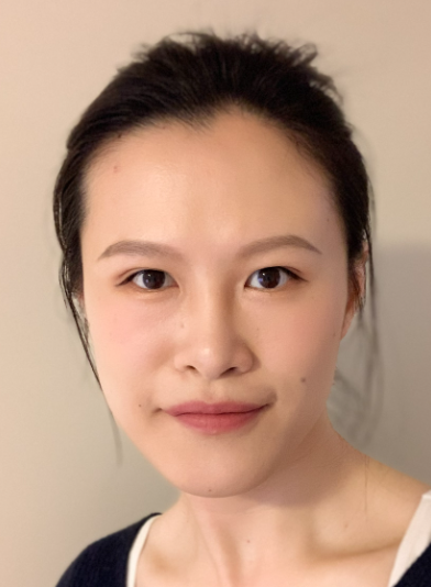 Xing Liu