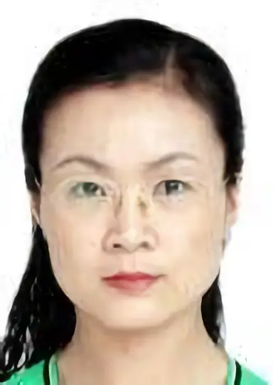 Huiling Zhao
